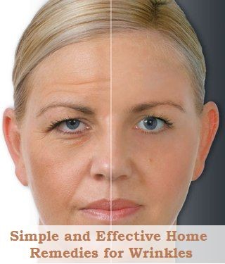Simple and Effective Home Remedies for Wrinkles