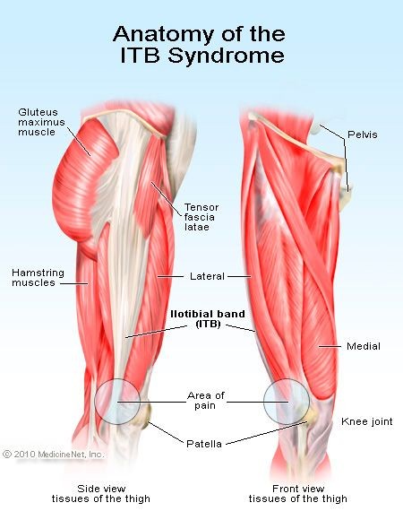 Iliotibial Band Syndrome is a common problem with...