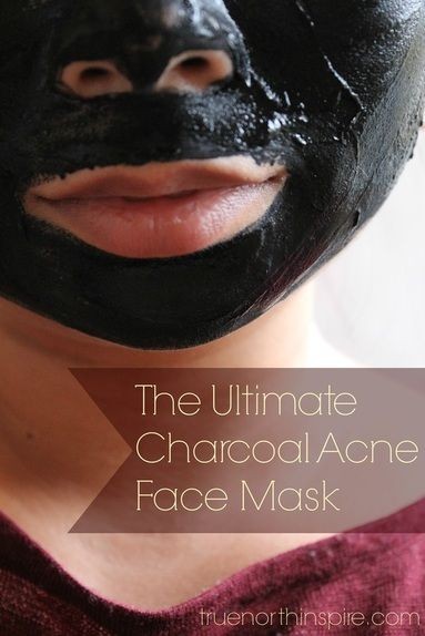 The Ultimate Charcoal Acne Face Mask! DIY and Home...
