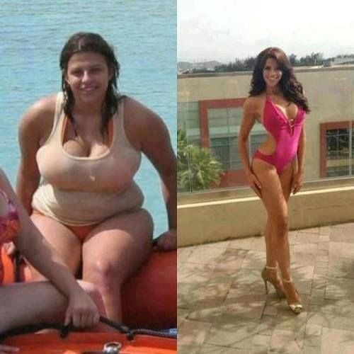 Before and After Weight Loss Photo - Before and Af...