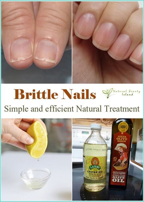 Treatment against Nails that Break